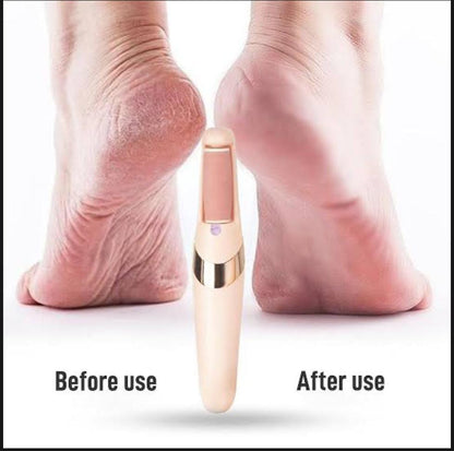 Rechargeable Foot Dead Skin Remover