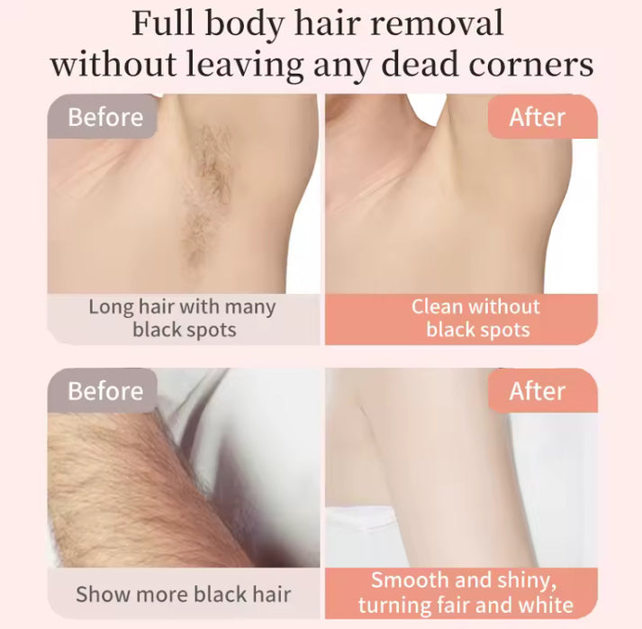 Rechargeable Dual Head Hair Remover